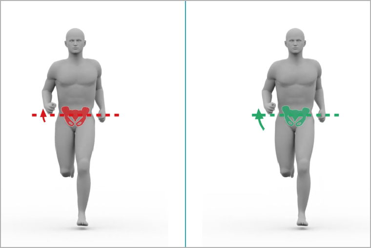 骨盤の引き上げ